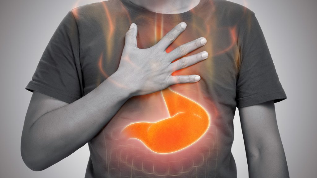 Are adjustable beds good for acid reflux